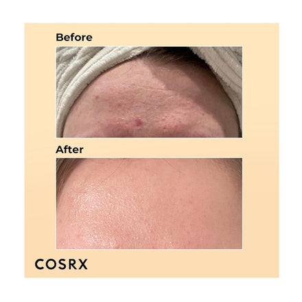 COSRX Advanced Snail 96 Mucin Power Essence 100ml